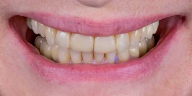 Авторская стоматология CELEBRITY CLINIC фотография 21