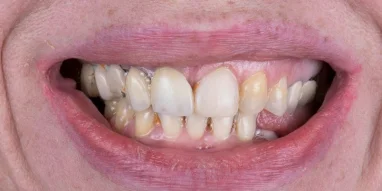 Авторская стоматология CELEBRITY CLINIC фотография 16