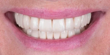 Авторская стоматология CELEBRITY CLINIC фотография 13