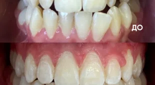 Стоматология Студия кристальных зубов 